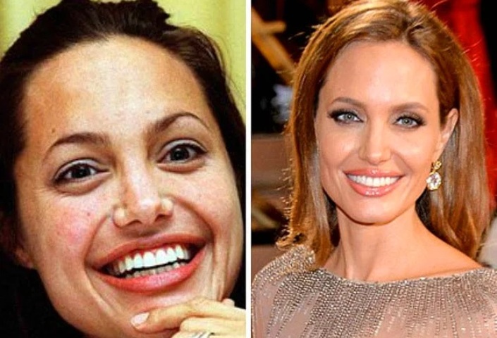 Как выглядят отечественные и голливудские звезды без макияжа