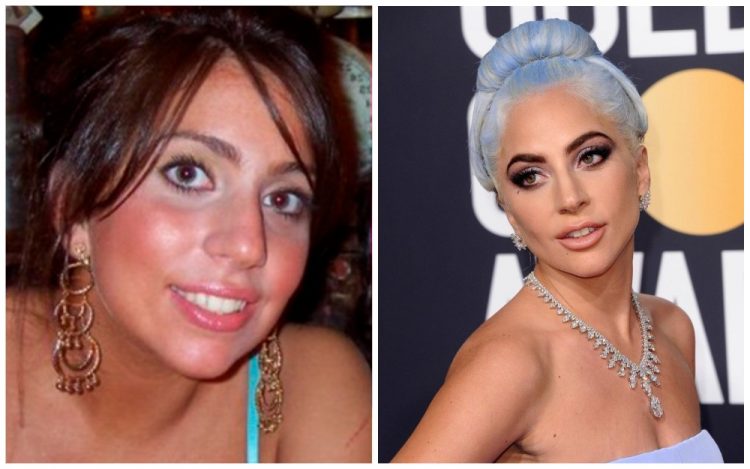 Як виглядали зірки до того, як стали знаменитими: до та після
